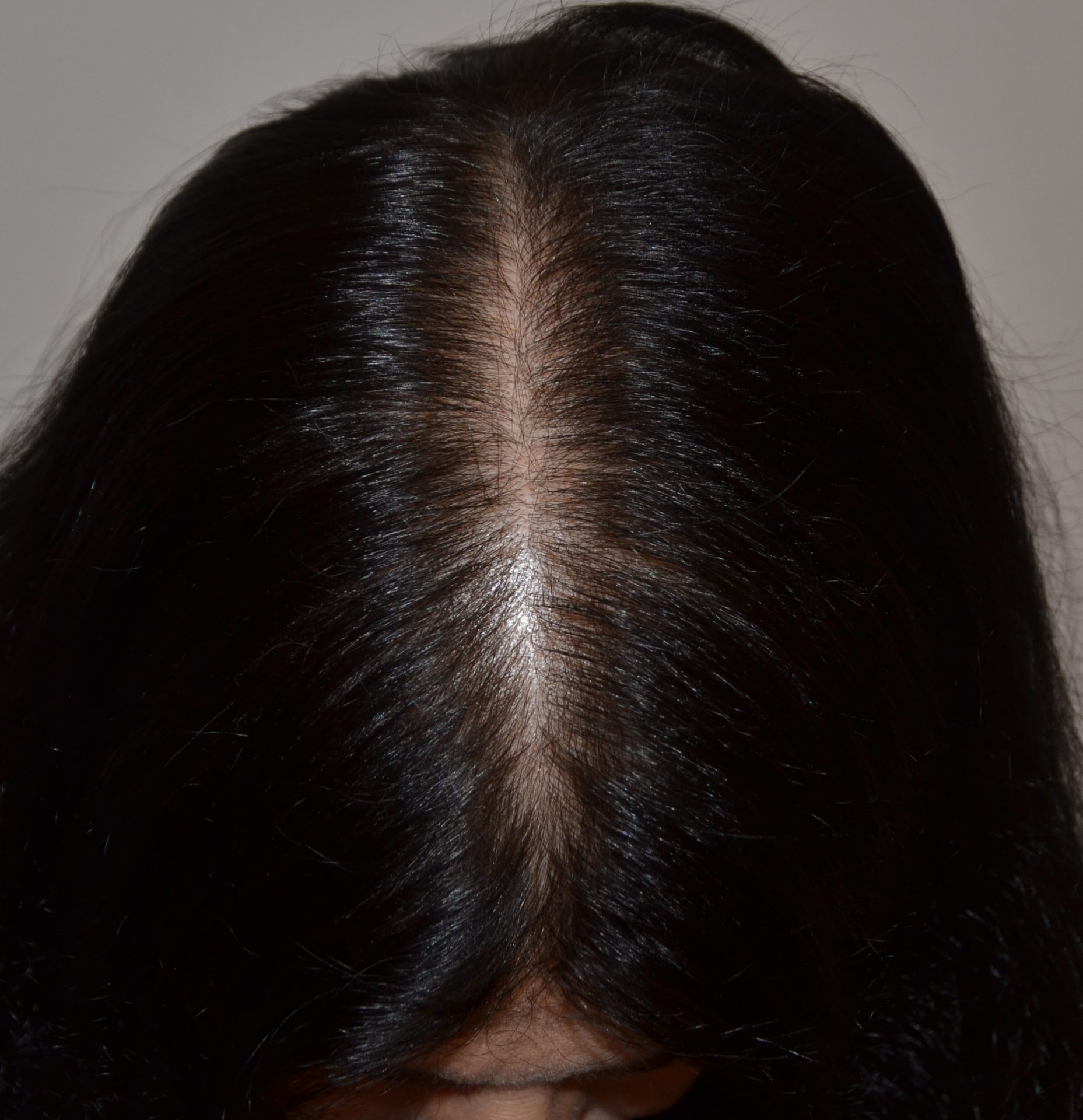 Caduta dei capelli in autunno: cause e rimedi