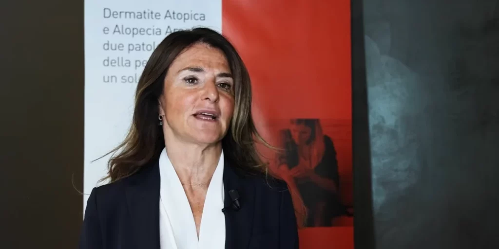 Alopecia areata: come funziona baricitinib. primo farmaco specifico per la malattia