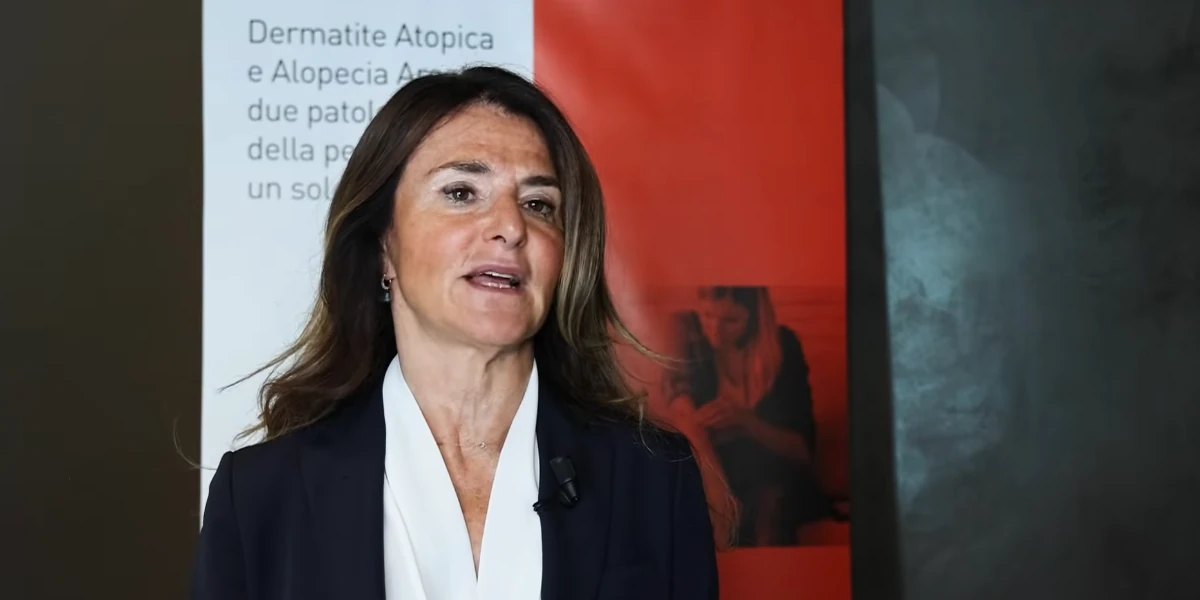 Alopecia areata: come funziona baricitinib. primo farmaco specifico per la malattia