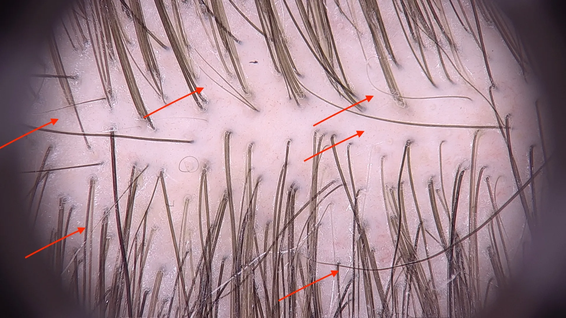 capelli corti in ricrescita