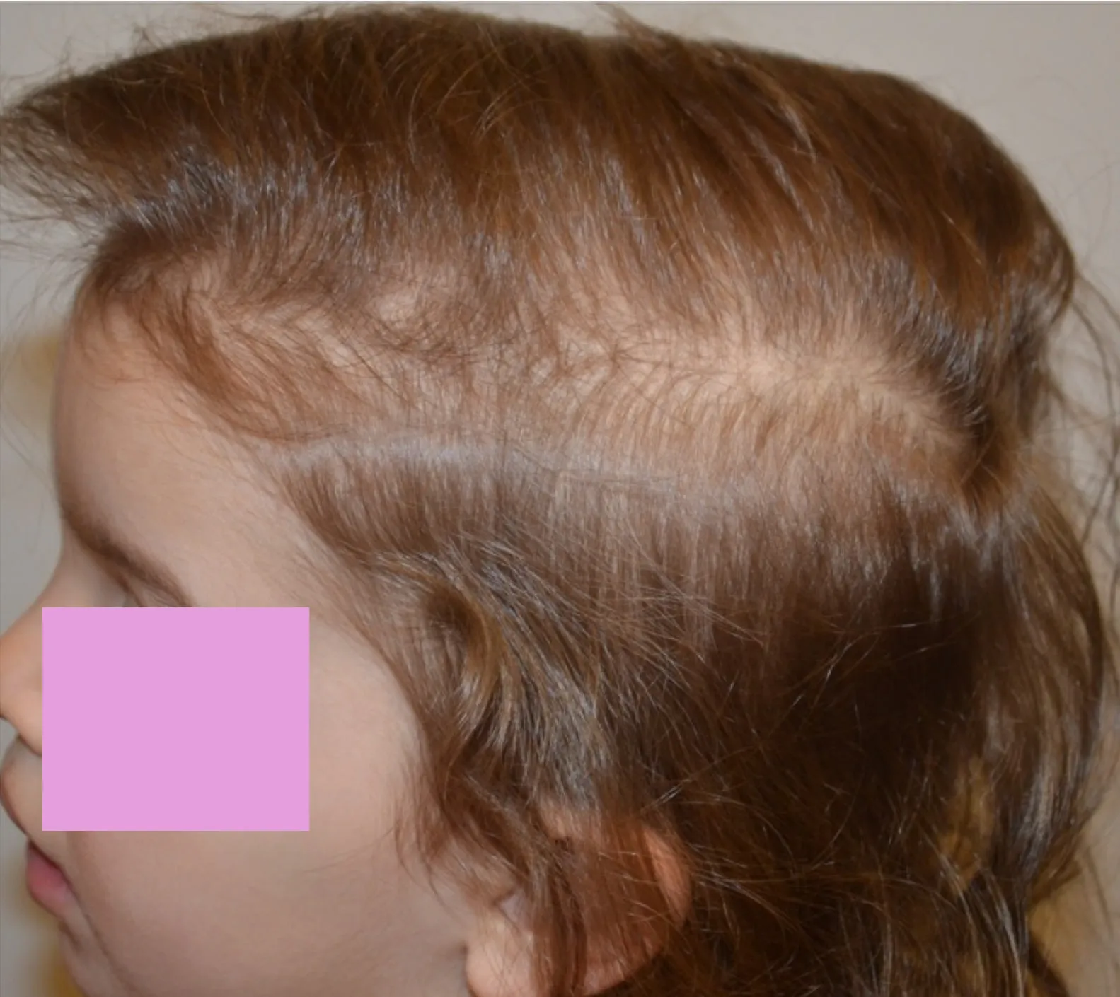 I capelli nei bambini