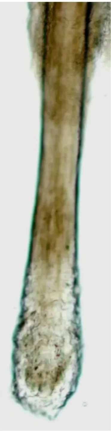 Fig.1 Radice telogen dei capelli che cadono durante la stagione autunnale.